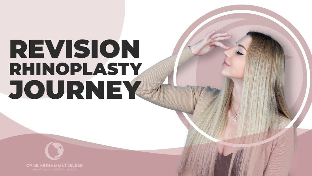 Daria’s successful Revision Rhinoplasty Journey